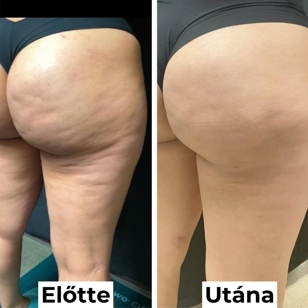 Combfeszesítő krém